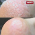 Крем-піна з 10% сечовиною та маслом троянди для ніг 125 мл (CREMESCHAUM ROSE), PEDIBAEHR