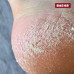 Трояндовий крем з сечовиною для ніг 30 мл (ROSE CREAM), PEDIBAEHR