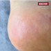 Трояндовий крем з сечовиною для ніг 30 мл (ROSE CREAM), PEDIBAEHR