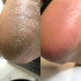 Nailsoftheday Podology+ КЕРАТОЛІТИК для стоп, urea 20%, 100 мл