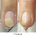 NAILSOFTHEDAY ONISTOP регенеруюча олія проти оніхолізису, 15 мл NAILSOFTHEDAY ONISTOP регенеруюча олія проти оніхолізису, 15 мл