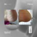 Resultum Regenerix крем от трещин для рук и стоп, 25 мл Resultum Regenerix крем от трещин для рук и стоп, 25 мл